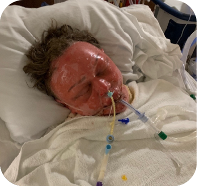 From Ashes to Advocacy: Pamelas Journey of Resilience A testament to the human spiri